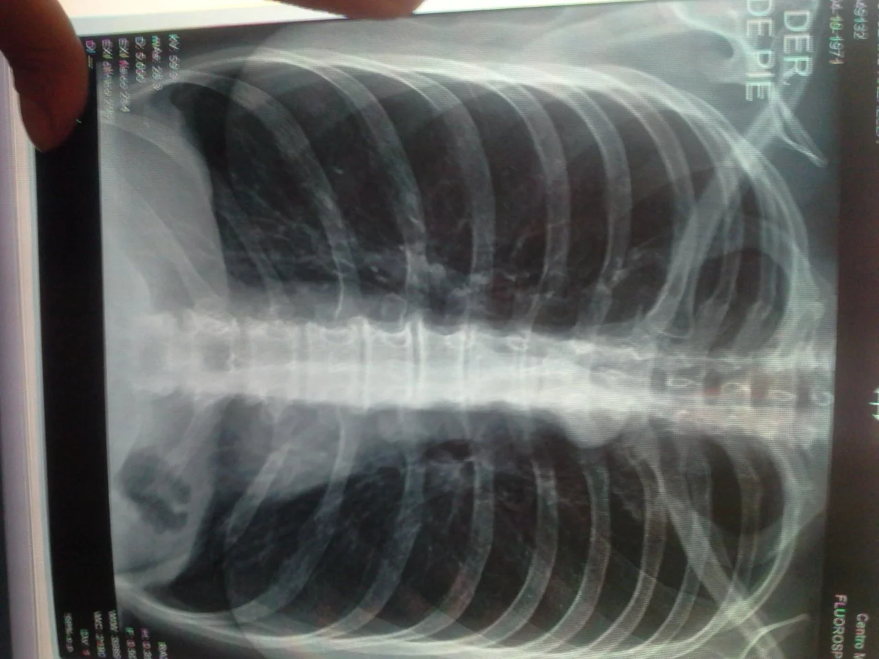 20181006_121959.webp 20181006_121959.webp