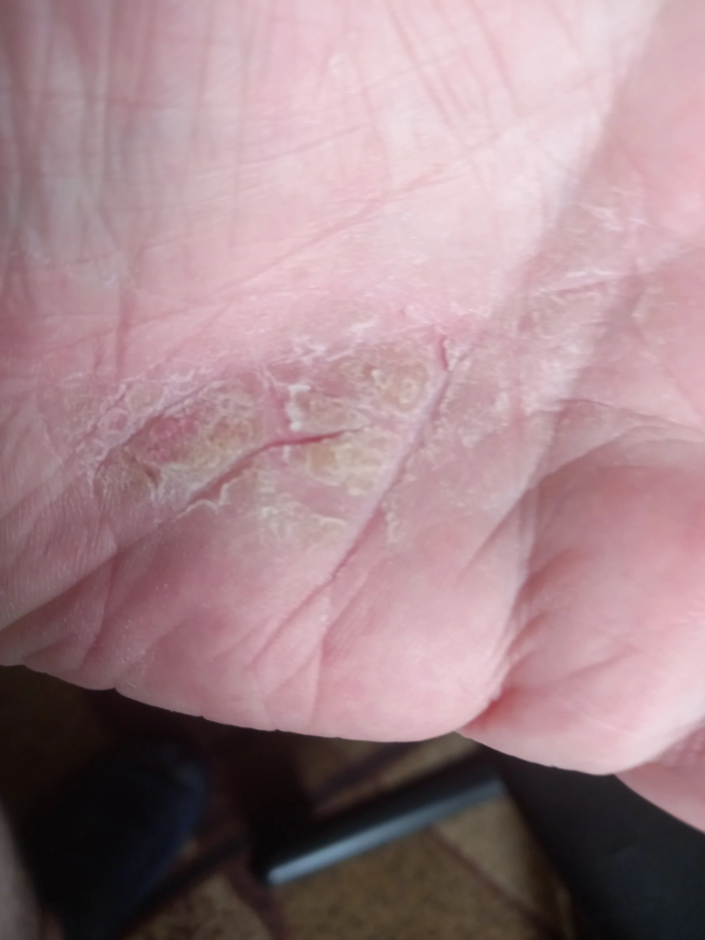 2022-07-22 10-33-00.webp