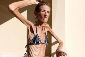 Без названия (8).webp