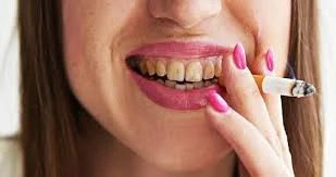 Без названия.webp