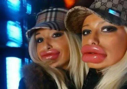 big-lips.webp