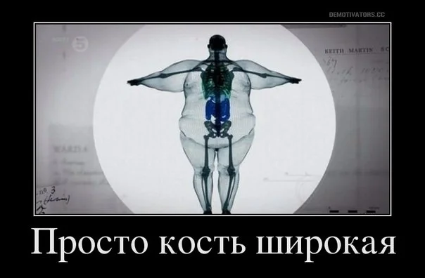 кость широк.webp