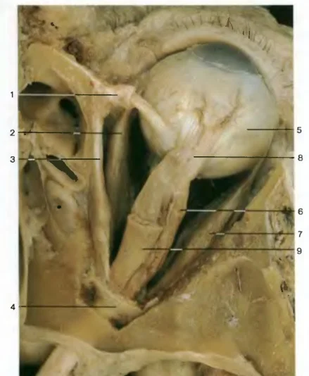 Мышцы глаза.webp