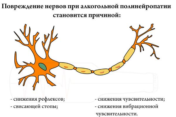 nerve-3483.jpg