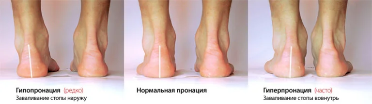 pronation-768x216.webp