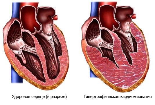 Сердца в разрезе.jpg