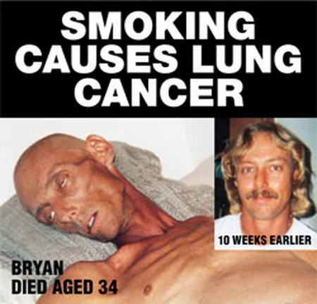 Smoking causes lung cancer.webp