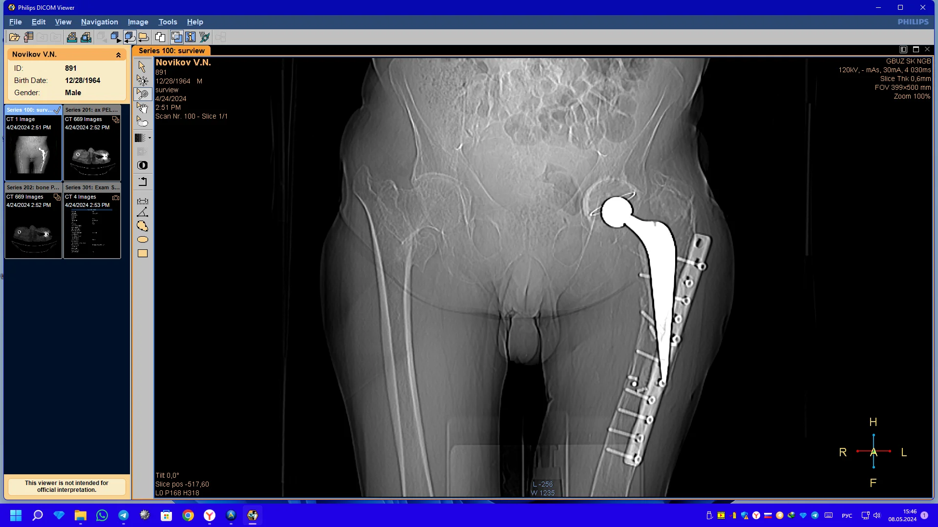 Снимок экрана (1).webp