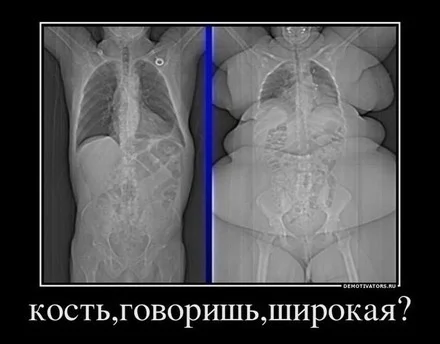 x_9db0928d.webp