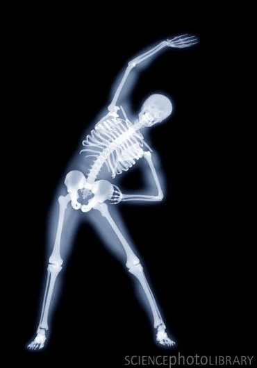 yoga-xray5[1].webp