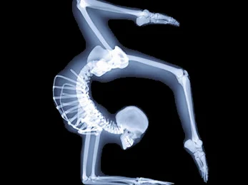 yoga-xray6[1].webp