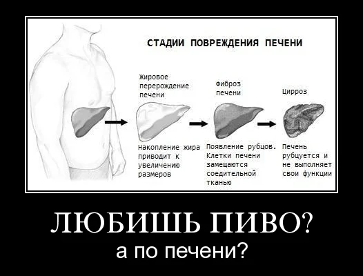 Что будет если каждый день пить пиво