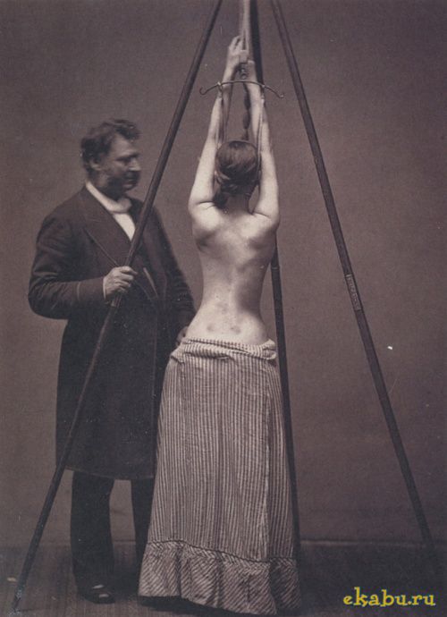 Лечение сколиоза, 1870–е, США.jpeg