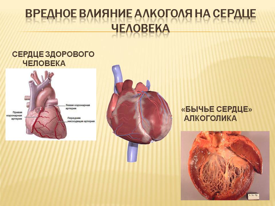 Сердце алкоголика и здорового человека фото