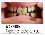Внимание: сигареты вызывают рак!