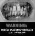 Влияние курения на органы дыхания и полость рта